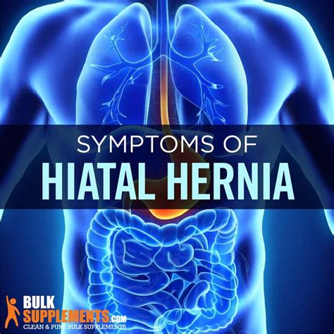 Hiatal Hernia Symptoms Causes Treatment
