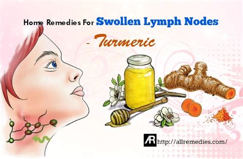 42 Home Remedies For Swollen Lymph Nodes Causes Symptoms Tips