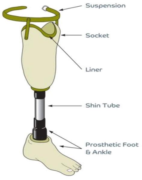 Prosthetics For Lower Limb Amputation Intechopen
