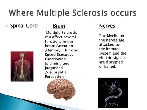 Ppt Multiple Sclerosis Powerpoint Presentation Free Download Id 1867144