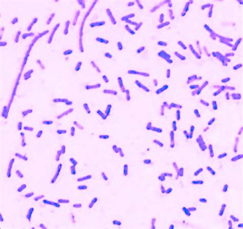 Gram Staining Showing Subterminal Spore In Gram Positive