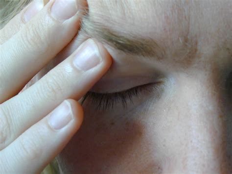 Ocular Migraine Diagnosis