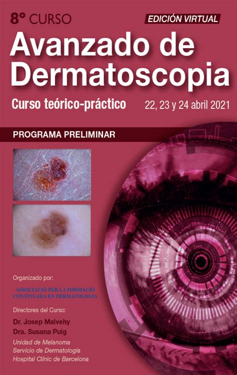 Curso Avanzado De Dermatoscopia Edición Virtual 22 23 24 Abril 2021