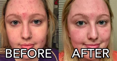 Taking vitamin c supplements may help naturally support healthy blood pressure.* it promotes the body's production of a molecule called nitric oxide. This Vitamin C Face Serum May Give You The Best Dang Skin ...