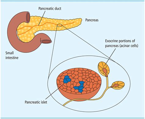 Pancreatic Exocrine Dysfunction Common In Type 3c Diabetes But Dont Forget Types 1 And 2