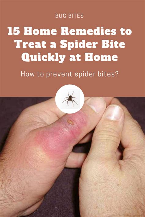 How To Identify A Spider Bite And Treat It Spider Bit Vrogue Co