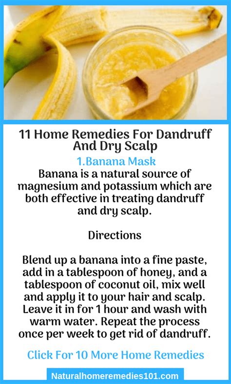 11 Home Remedies For Dandruff And Dry Scalp Home Remedies For