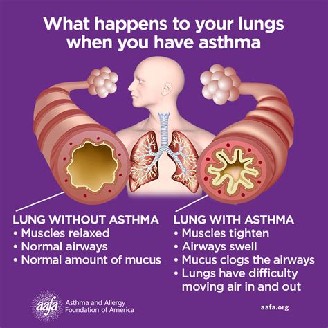 What Are Asthma Symptoms Aafa Org