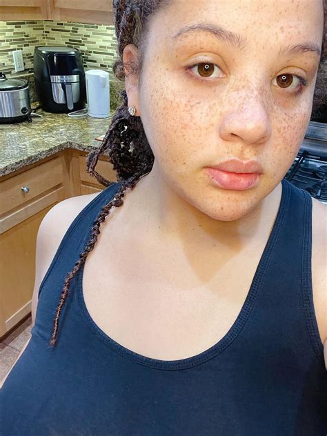 post gym freckled face 😊 r freckledgirls