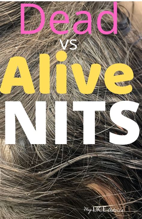 Dead Vs Live Nits Color Of Lice Eggs Lice Eggs Louse Lice Facts