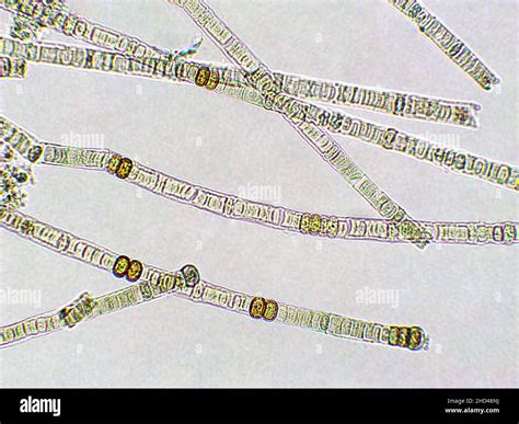 Nodularia Algae Under Microscopic View Nitrogen Fixing Cyanobacteria