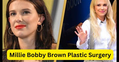 Has Millie Bobby Brown Had Plastic Surgery Know The Truth Behind The