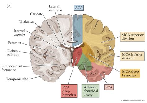 Middle Cerebral Artery MCA Stepwards