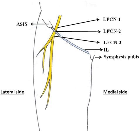 Scielo Brasil Microanatomy Of The Lateral Femoral Cutaneous Nerve In Relation To Inguinal