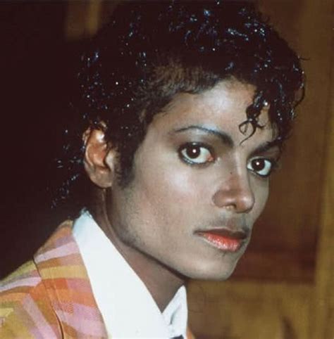 Michael Jackson Лечение витилиго Майкл джексон Джексон