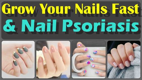 Top 10 Ways To Grow Your Nails Fast And Home Remedies For Nail