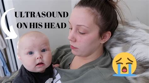 Found Lump On Babys Head Ultrasound Appt For Baby Youtube