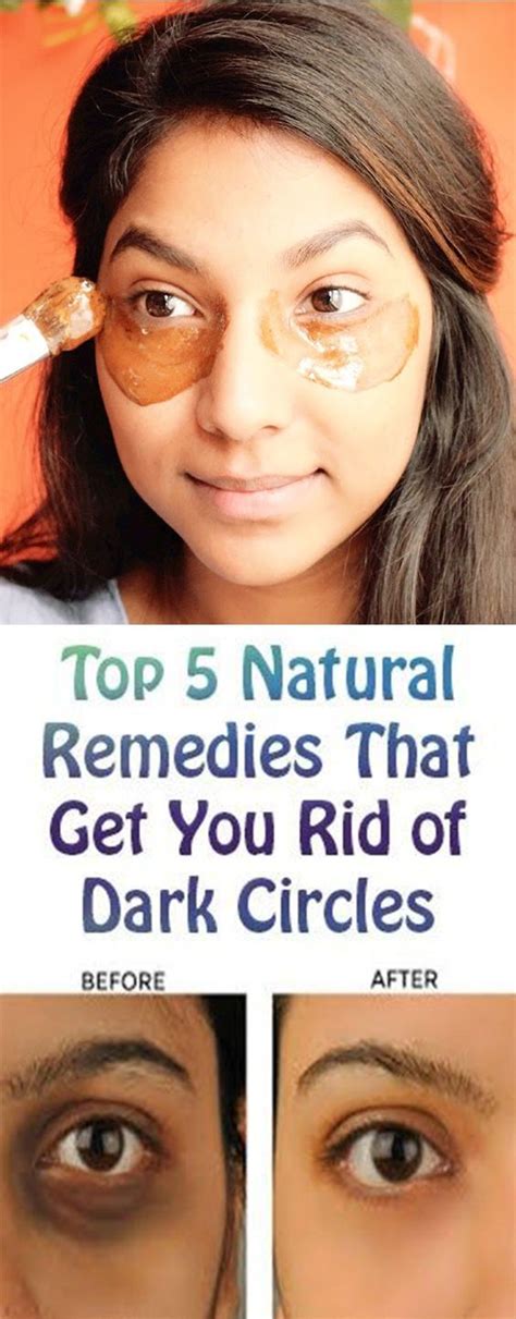 Home Remedies To Get Rid Of Dark Circles Under The Eyes