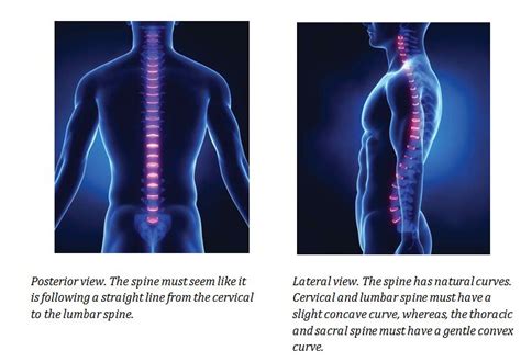 why chiropractors promote good posture chiropractic therapy and health