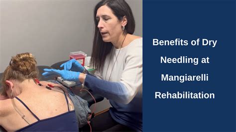 benefits of dry needling at mangiarelli rehabilitation mangiarelli rehabilitation