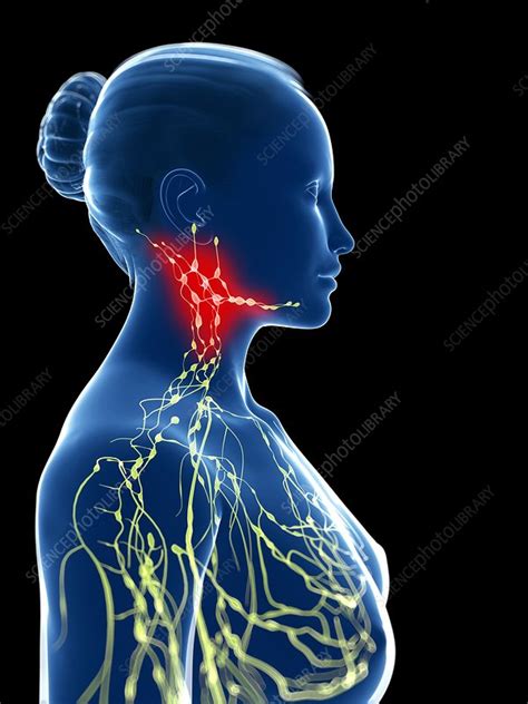 Inflamed Lymph Nodes Artwork Stock Image F0077332 Science Photo