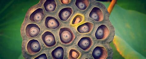 Watch Understanding Trypophobia A Fear Of Holes Sciencealert