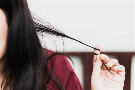 What Is Trichotillomania Know The Causes Symptoms And Treatment