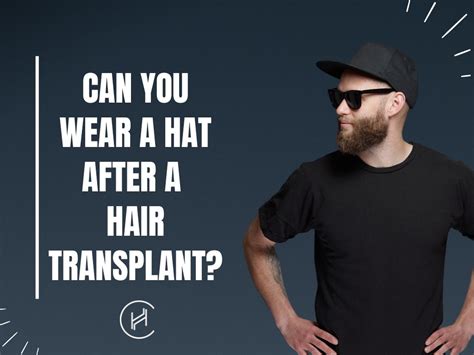 Update Hair Transplant Sun Exposure In Eteachers