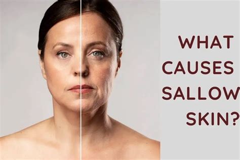 What Causes Sallow Skin Olive Skin Beauty