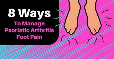 8 Ways To Manage Psoriatic Arthritis Foot Pain Mypsoriasisteam