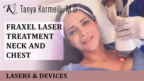 Fraxel Laser Treatment Of The Neck And Chest Youtube
