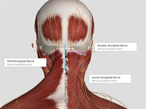 Revision Of Migraine Headache And Occipital Neuralgia Surgery