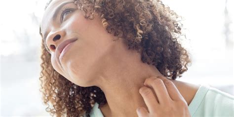 Rash On Neck Meaning Causes Itchy Red Bumpy Rash Diagnosis And Treatments American Celiac