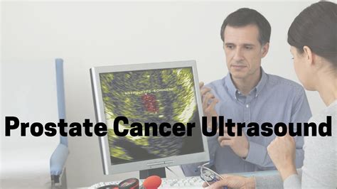 Prostate Cancer Ultrasound YouTube