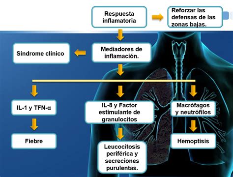 Fisiopatología De La NeumonÍa Enfermedicos Mx