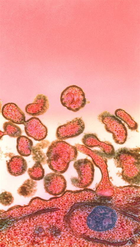 Measles Virus Photograph By Nibscscience Photo Library Fine Art America