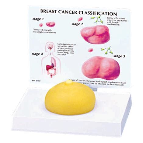 Anatomical Breast Cancer Model Assessments