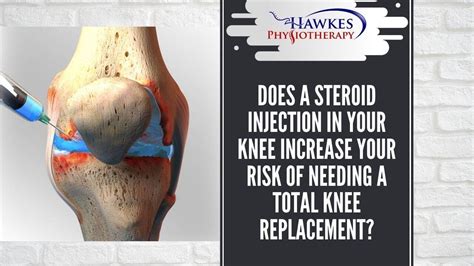 Does A Steroid Injection In Your Knee Increase Your Risk Of Needing A Total Knee Replacement