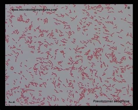 Pseudomonas Aeruginosa Scheda Batteriologica Ed Approfondimenti