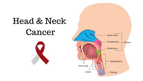 Head And Neck Cancer Signs Symptoms Risk Factors Treatment