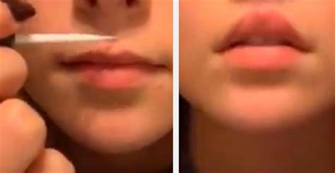 Un Nouveau Défi Dangereux Des Adolescentes Se Collent Les Lèvres Pour