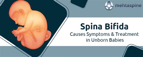 Spina Bifida Causes Symptoms And Treatment In Unborn Babies