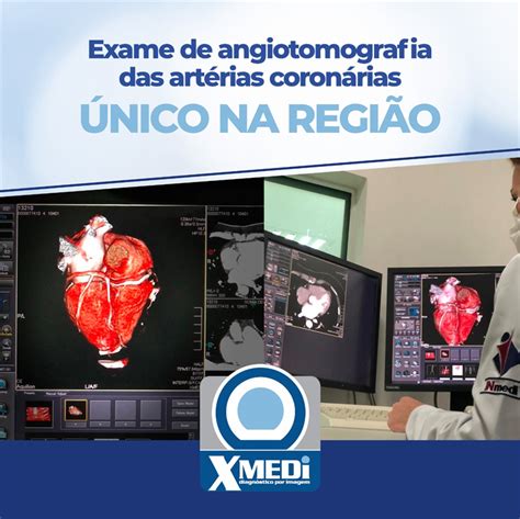 Exame De Angiotomografia Das Artérias Coronárias