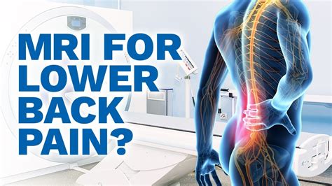 Do I Need An Mri For Lower Back Pain True Or False Youtube