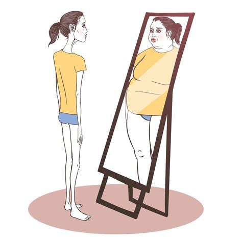 Bulimarexia Bulimia Y Anorexia Cronic Es Portal De La Asociaci N
