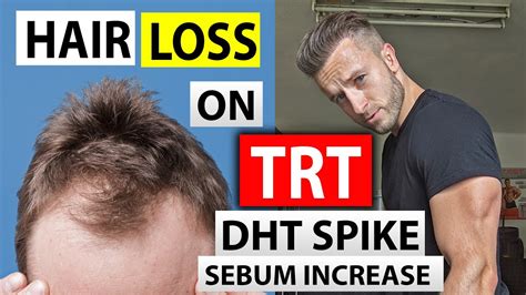 testosterone and hair loss trt and dht spike is big 3 enough to save hair on trt youtube