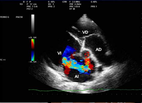Ecocardiograma Doppler Color Cardiologo Tijuana Cardiologia