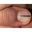 The Important Reason Why This Photo Of A Fingernail Has Gone Viral