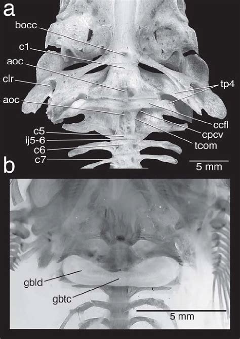 A Weberian Complex Post Weberian Vertebrae Basioccipital Region And