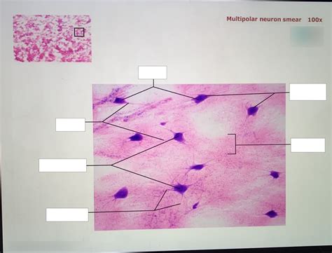 Multipolar Neuron Smear 100x Histology Diagram Quizlet